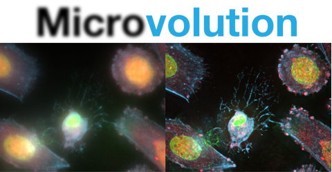 Microvolution Deconvolution Software